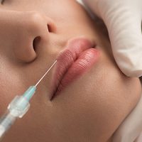 lips-shaping lips-shaping