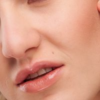 nasolabial-folds nasolabial-folds