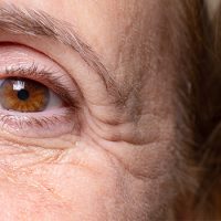 Anti-Wrinkle-Injections-Eternal-Youth-Medical-Aesthetics-03 Anti Wrinkle Injections Eternal Youth Medical Aesthetics 03