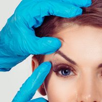 Anti-Wrinkle-Injections-Eternal-Youth-Medical-Aesthetics-05 Anti Wrinkle Injections Eternal Youth Medical Aesthetics 05