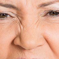 Anti-Wrinkle-Injections-Eternal-Youth-Medical-Aesthetics-07 Anti Wrinkle Injections Eternal Youth Medical Aesthetics 07