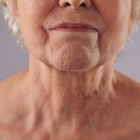 Anti-Wrinkle-Injections-Eternal-Youth-Medical-Aesthetics-11 Anti Wrinkle Injections Eternal Youth Medical Aesthetics 11