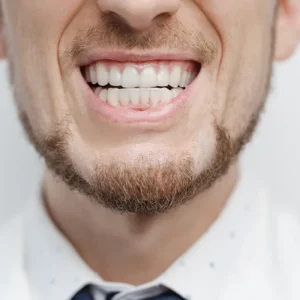 Teeth Grinding